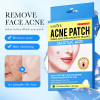 Точкові патчі від прищів SADOER Acne Patch, 36 шт.