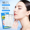 Точкові патчі від прищів SADOER Acne Patch, 36 шт.